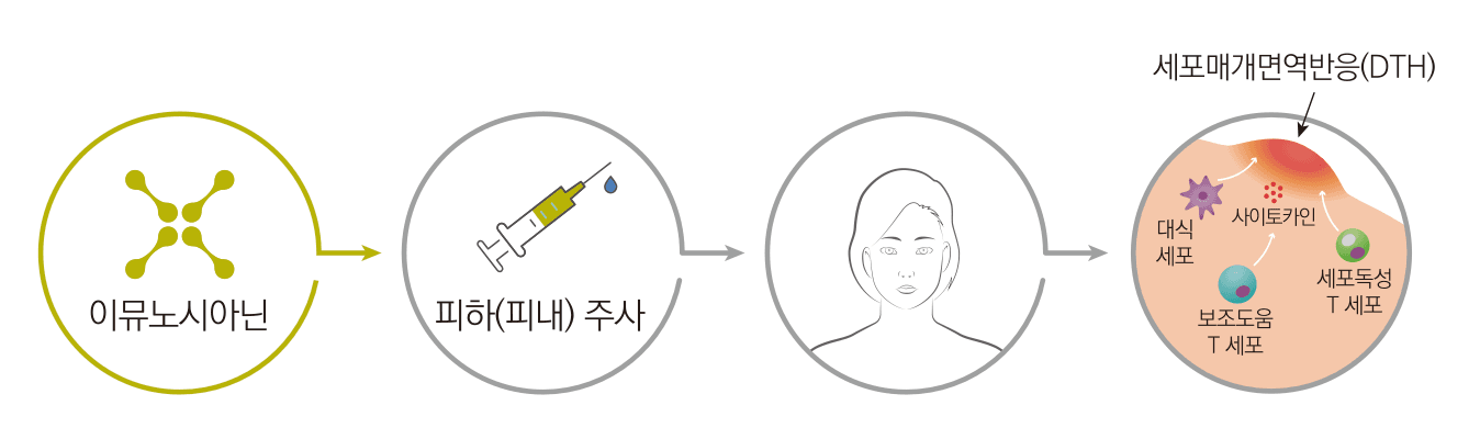 면역 자극 및 활성화