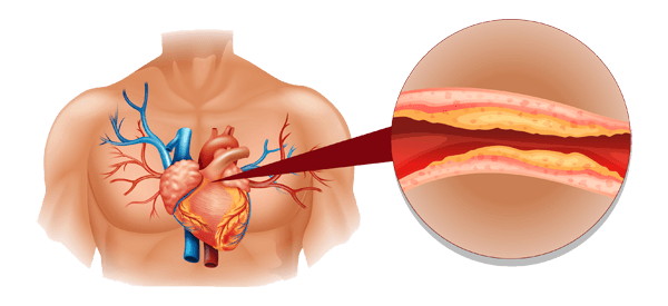 콜레스테롤 흡수 및 배출 이미지