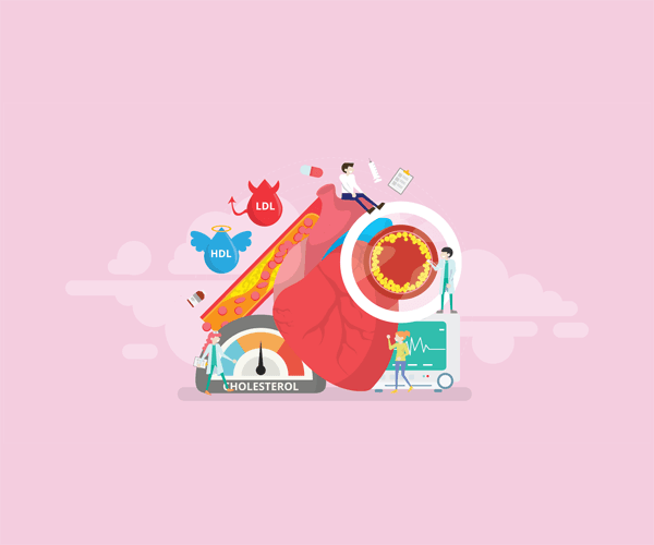 고지혈증 관리 이미지