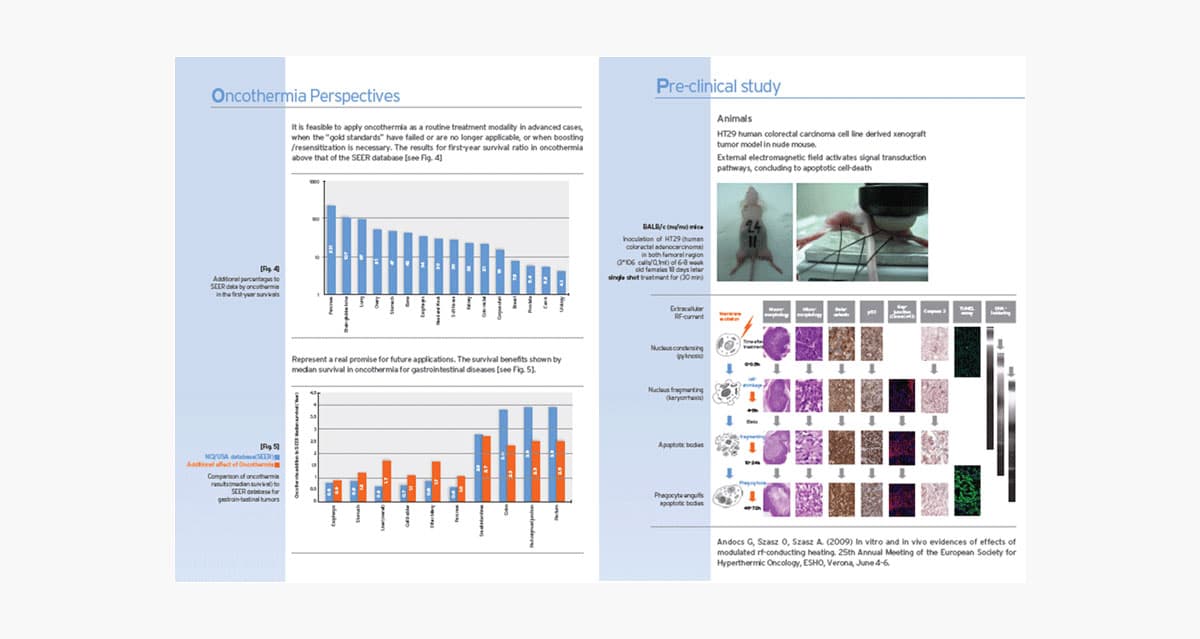 고주파 온열암치료의 임상연구결과